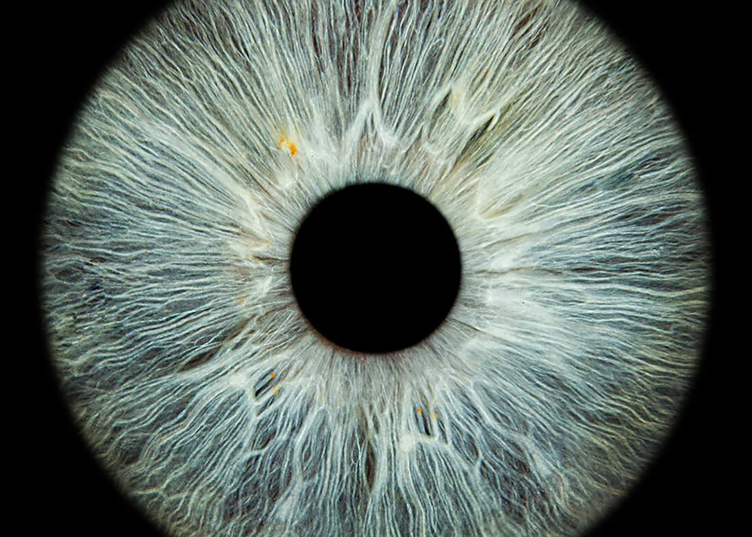 Graublaue Iris mit feinen Strukturen und schwarzer Pupille.